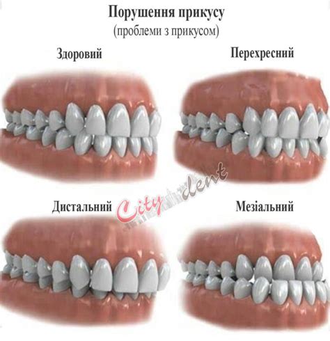 Хто такий лікар ортодонт? Як виправити неправильний прикус?