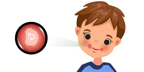 Импетиго: причины, виды, лечение, препараты и мази