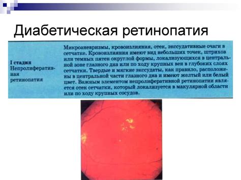 Патогенез диабетической микроангиопатии - презентация онлайн