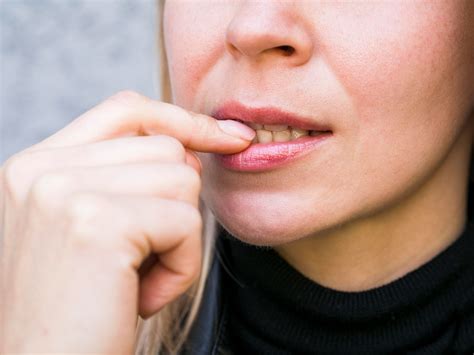 ᐉ Афти в Устата • Как да се справим с тях? | Dental Care Center