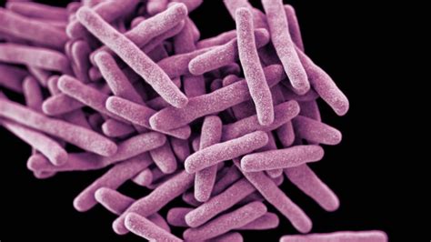 TB or not TB? That is the Question… | by Michael Trịnh | Good Audience
