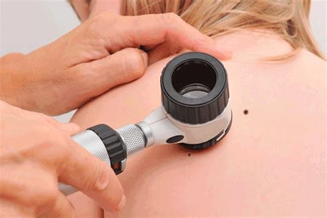 Dermatoscopia O Que É