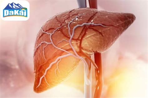 Các triệu chứng của bệnh gan nhiễm mỡ theo từng giai đoạn - Dakai