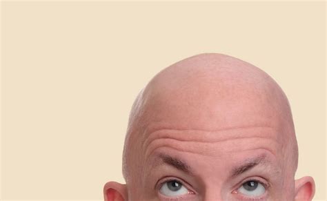The Benefits Of Being Bald. Unveiling the Astonishing Advantages of ...