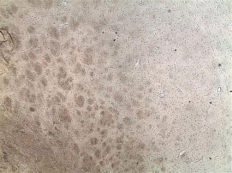 agrin antibody agr antibodiesprimary antibodies fisher scientific