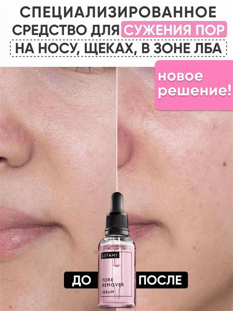 Сыворотка для очищения и сужения пор - купить с доставкой по выгодным ...