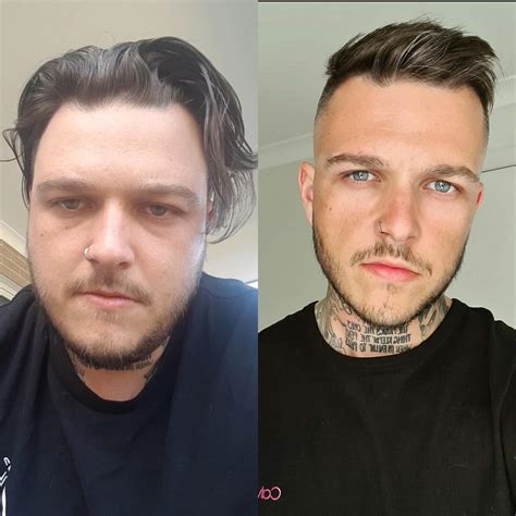 alcohol puffy face before and after 9