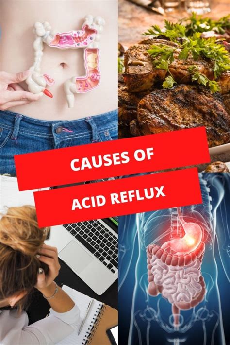 What Causes Acid Reflux? - Simply Noel