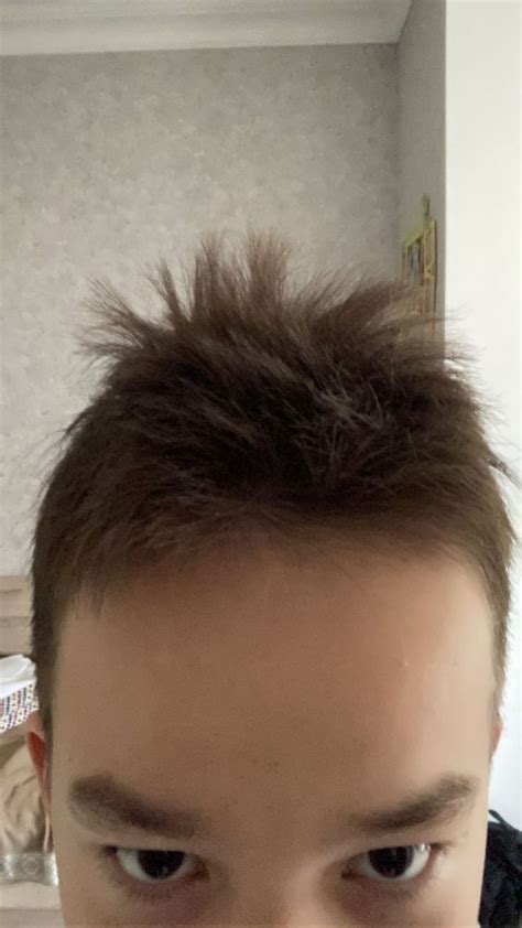 чупчик
