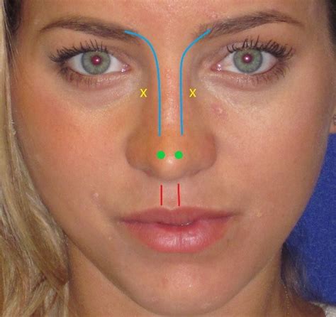 Bony Nose
