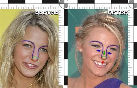 Blake Lively Didn’t Need a Nose Job to Be Famous - Rawnsley Plastic Surgery