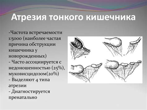 Хирургические патологии у новорожденных - презентация онлайн