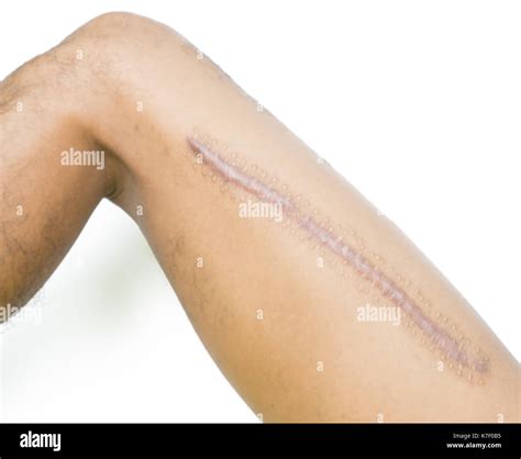 Femur Stock Photos & Femur Stock Images - Alamy