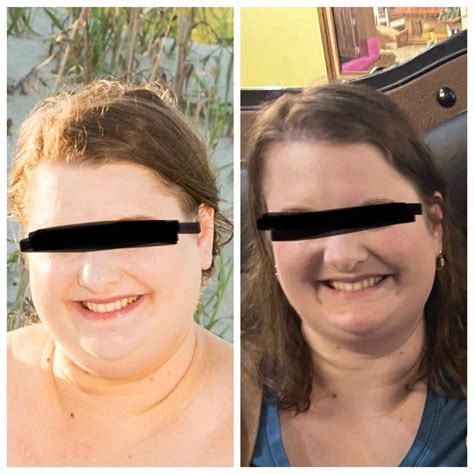 30+ pounds down, seeing it in my face. : r/Mounjaro