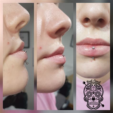 Vertical Labret Piercing Swelling Collectisale | instrumentation.kmitl ...