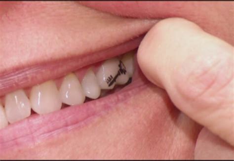 Dental tattoo или татуировки на зубах - Estet-Portal
