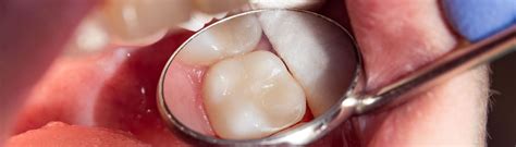 Inley Onley | Emident Diş Kliniği Mecidiyeköy