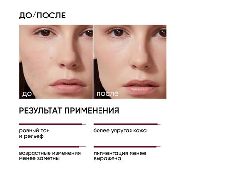 15% интенсивный пептидный пилинг купить Icon Skin
