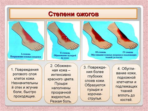 Что делать при ожоге у ребенка кипятком или утюгом. — Teletype
