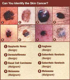 22 Medical - Integumentary ideas | medical, medical knowledge, nursing ...