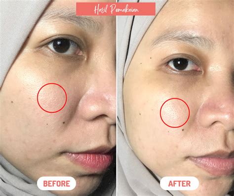 SNP Prep Peptaronic Serum Review, Hydration Serum For Oily Skin