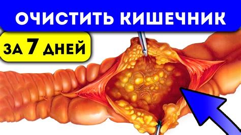 Самая сильная 7-ми дневная чистка кишечника. Как вывести шлаки, каловые ...