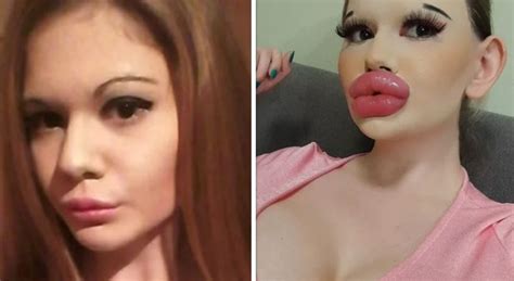 La donna con le labbra più grandi al mondo: «I miei fan mi pagano ...