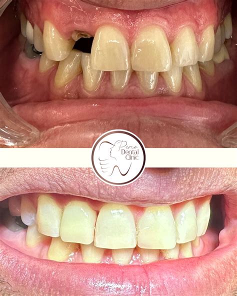 Perio Dental Clinic (@perio.dentalclinic) • Instagram photos and videos