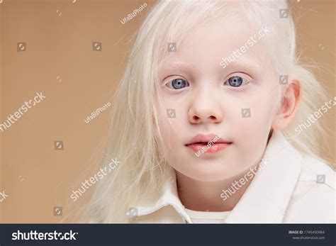 Albino