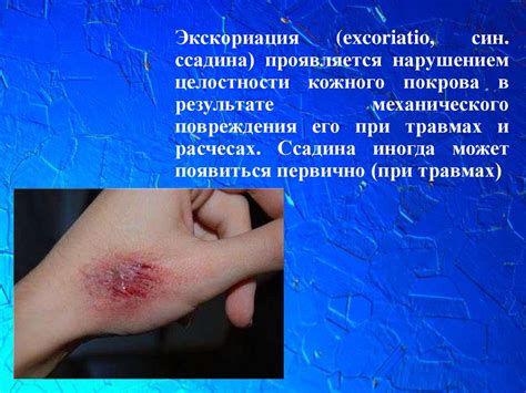Морфологические элементы - презентация онлайн