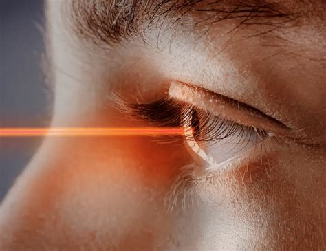 laser eye surgery cost lasik price brisbane