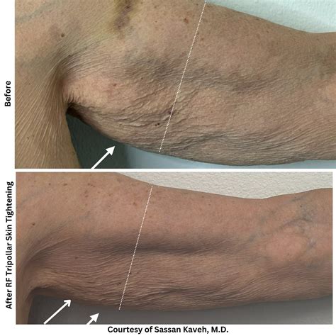 Alpha Medical Aesthetics - Medical Spa - Las Vegas, NV