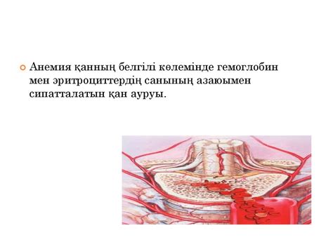 Анемиялар - презентация онлайн