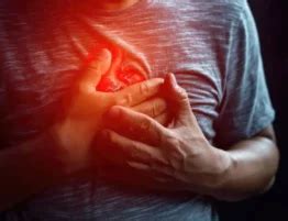 myocardial infarction stemi  nstemi lone star neurology