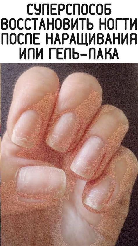 Отличный способ восстановить ногти после наращивания или гель-лака in ...