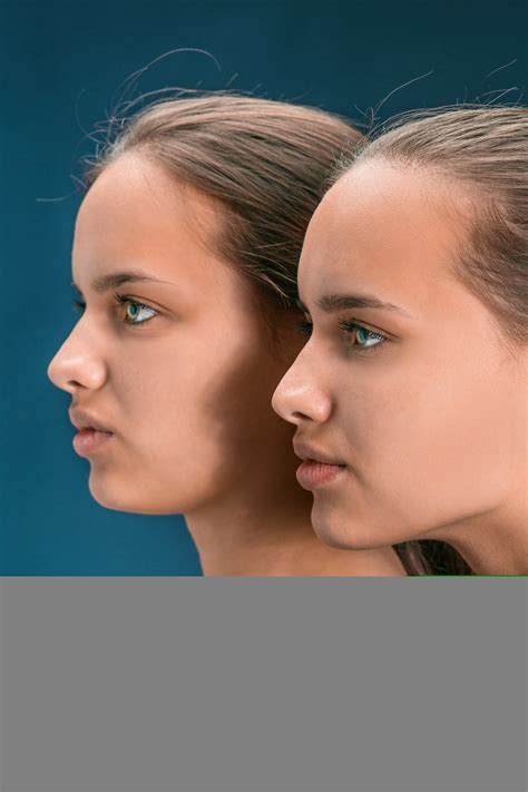 plastic surgery before and after