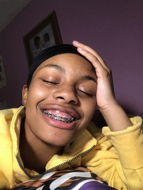 49 Pretty girls with braces ideas | cute braces, brace face, braces colors