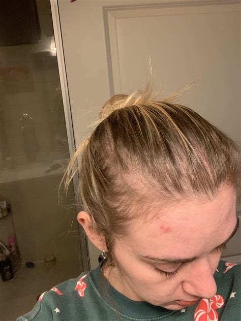 Super self-conscious about my hair thinning - looking for advise 😳 : r