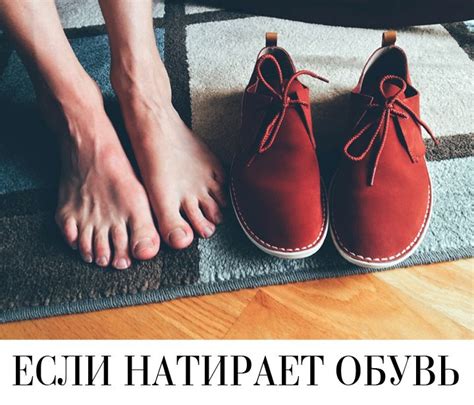 Что делать, если натирает обувь? | Блог ITAITA