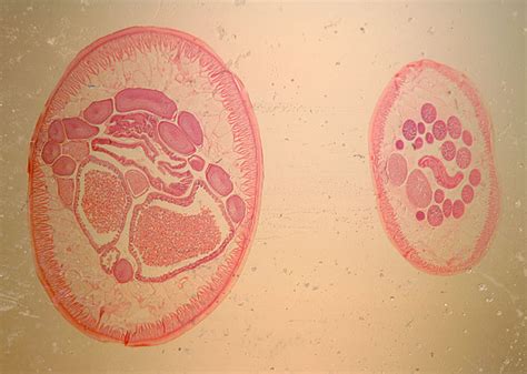 Diseases of the Digestive System