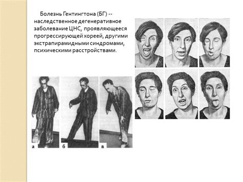 Презентация - Болезнь Гентингтона » Привет Студент!