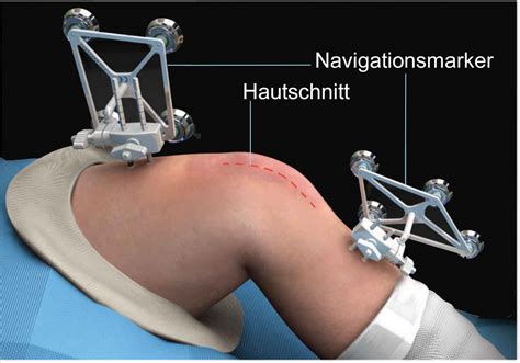 Das Neue Kniegelenk _ Das Kniegelenk Anatomie – GLJY