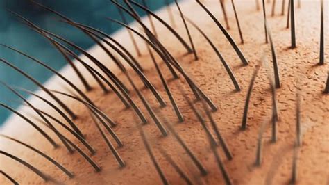 3d Scene Lots Tiny Hairs Skin Stock Footage Video (100% Royalty-free ...