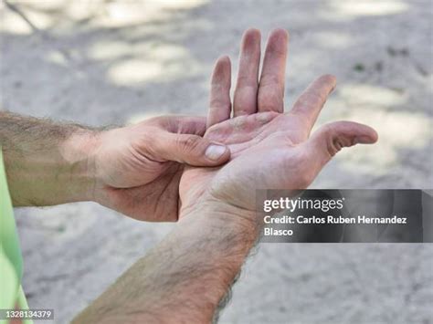 1,005 Calluses Stock Photos, High-Res Pictures, and Images - Getty Images