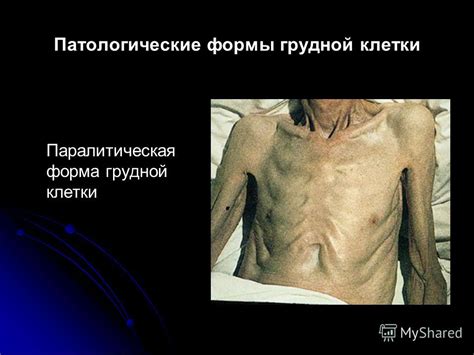 Презентация на тему: "Лекция « Обследование больных с заболеваниями ...