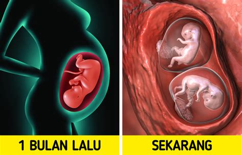 Sebagian Wanita Bisa Hamil Lagi saat Sedang Hamil, Inilah Penjelasannya ...