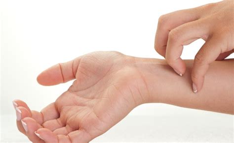 Skin Disorders