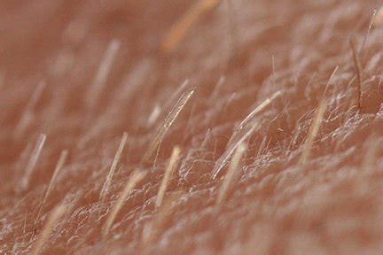 What is Vellus Hair? - Hair Transplant Mentor