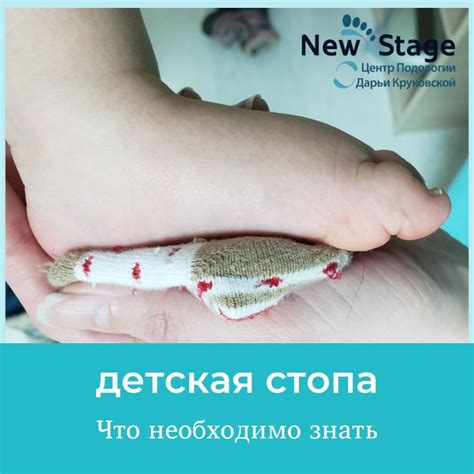 ДЕТСКАЯ СТОПА! Что нужно знать? - New Stage