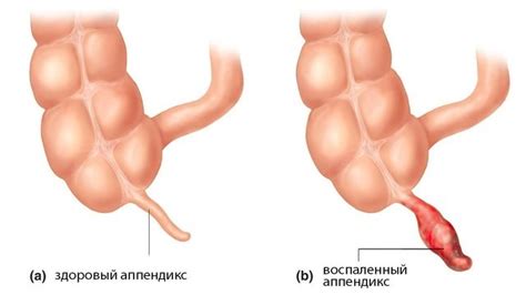 Аппендикс ⋆ Господь грядет